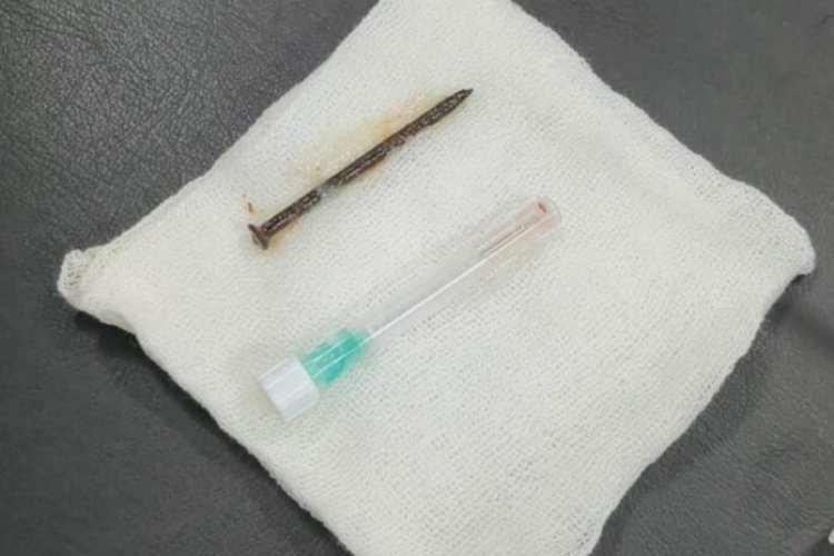 Tanpa Operasi Bedah, RSUD Arifin Achmad Riau Berhasil Tangani Pasien Tersedak Paku 5 Cm